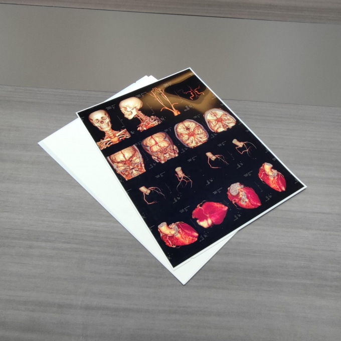 فیلم رادیولوژی (white film) وایت فیلم سایمان تک سلامت